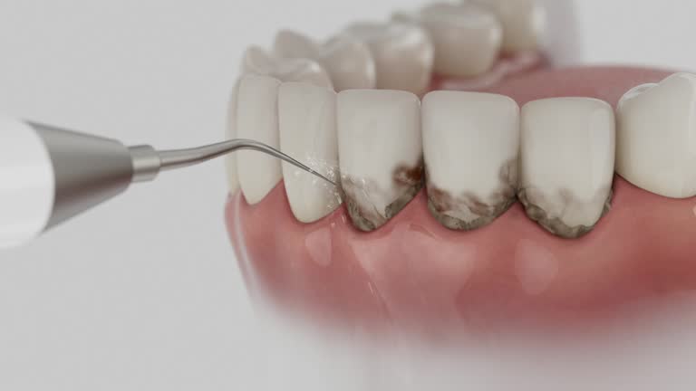 Trusted Dental Implants service in Cypress, CA - Dentist Open Now